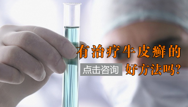 冬季脓包型牛皮癣注意事项 冬季脓包型牛皮癣注意事项