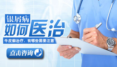 冬季寻常型牛皮癣怎么护理 冬季寻常型牛皮癣怎么护理