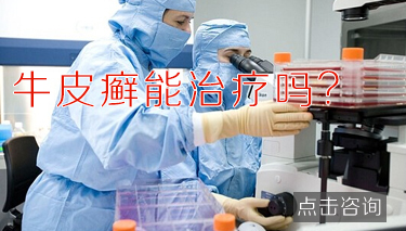 冬季红皮型牛皮癣如何护理 冬季红皮型牛皮癣如何护理