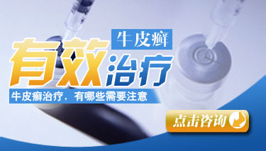 冬天如何预防红皮型牛皮癣发作 冬天如何预防红皮型牛皮癣发作