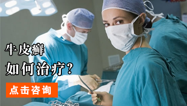 冬季关节型牛皮癣如何预防 冬季关节型牛皮癣如何预防